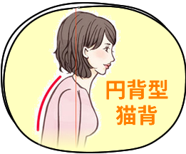円背型猫背女性イラスト