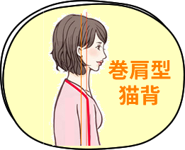 巻肩型猫背