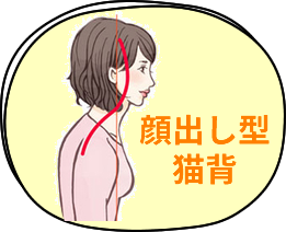 顔出し型猫背